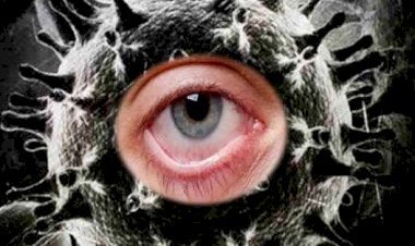 राजस्थान सरकार ने भी हरियाणा की तर्ज पर ब्लैक फंगस बीमारी को किया महामारी घोषित,  चिरंजीवी योजना में हो पाएगा इलाज