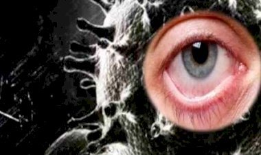 जालोर जिले में भी ब्लैक फंगस की दस्तक,  कोरोना पॉजिटिव हुए व्यक्ति के मिले लक्षण 