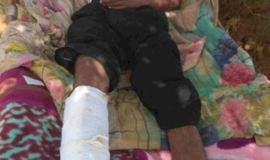 ट्रेक्टर-बाइक की टक्कर में बाइक सवार युवक के पांव में हुआ था 3 जगह फैक्चर, हेडकांस्टेबल राजाराम प्रजापत ने इलाज कराना तो दूर धमकाकर भगाया