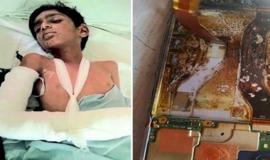मोबाइल बैटरी में धमाके के साथ ब्लास्ट, ऑपरेशन कर काटनी पड़ी 5वीं कक्षा के बच्चे की हथेली