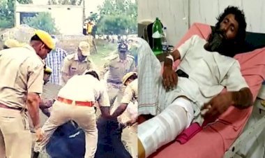 भरतपुर में अब संत के तोड़ दिए हाथ-पैर, अस्पताल में चल रहा इलाज