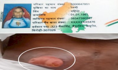 पेट से बाहर निकल रही गंभीर बीमारी के दर्द से तड़प रहा मरीज! खर्चा अधिक, नहीं करा पा रहा इलाज़