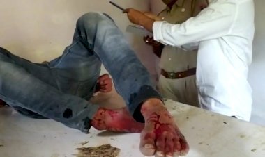 परिजन जता रहे हत्या की आशंका, मौका रिपोर्ट दे रही गवाही पर पुलिस नहीं मान रही थ्योरी